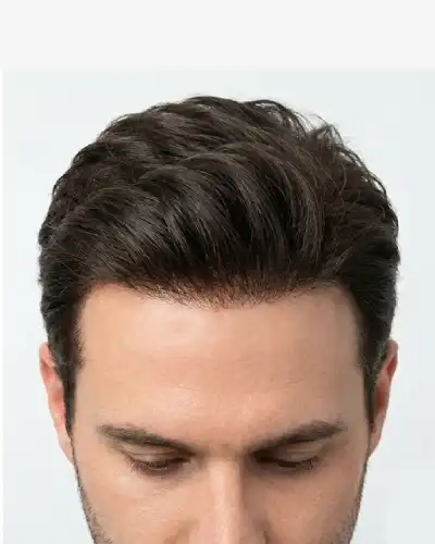 Frontal Hair Lace Patch Service After