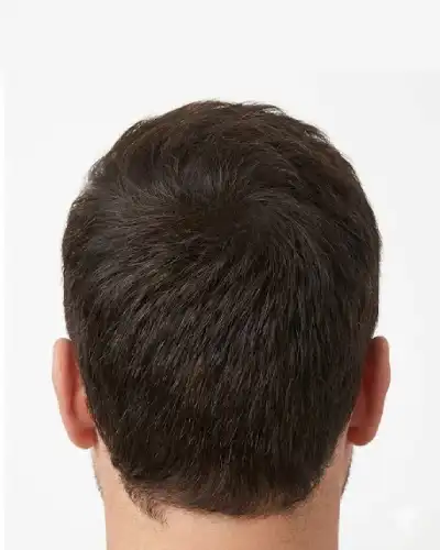 Volumizing Hair Patch After
